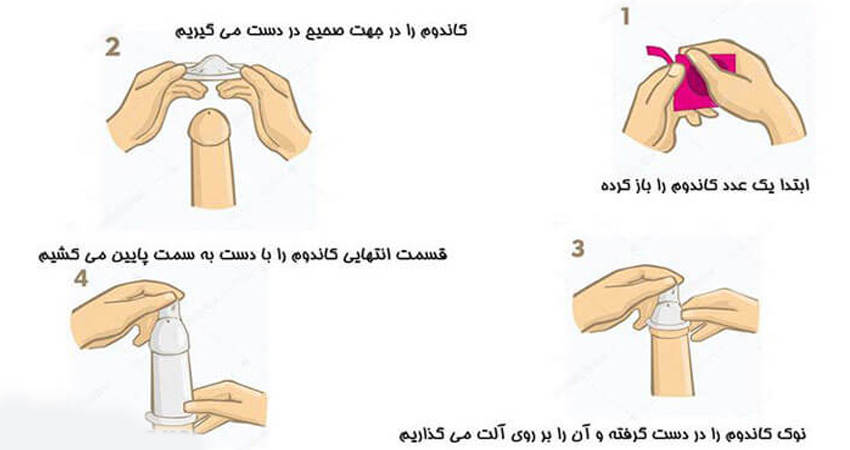 دیر گذاشتن کاندوم در رابطه جنسی