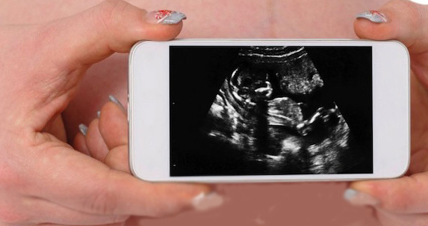 تست بارداری با نرم افزار موبایل چگونه است؟ 