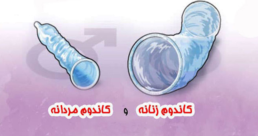 کاندوم زنانه چیست 	